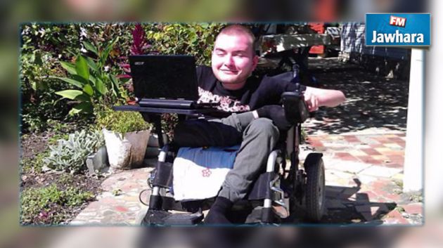 وُصف بالمجنون : جراح إيطالي يستعد لإجراء عملية زرع رأس لإنسان