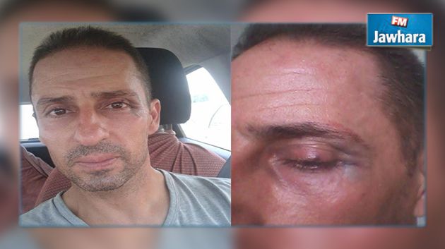 الاعتداء بالعنف على صاحب حملة