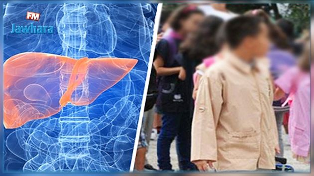 القصرين : إصابة 4 تلاميذ بالتهاب الكبد الفيروسي صنف 