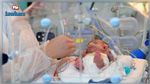 مستشفى سهلول: نجاح طبي جديد في إجراء عملية دقيقة على قلب رضيع