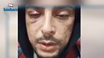 شاب تونسي: تعرّضت للعنف الشديد بعد رفضي تقديم رشوة لدورية أمنية (فيديو)