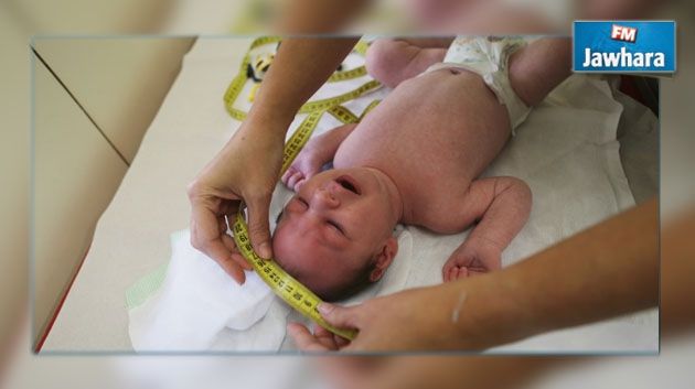 Europe: Naissance du premier bébé atteint de microcéphalie due au virus Zika