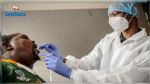 La maladie à virus de Marburg détectée pour la première fois au Ghana