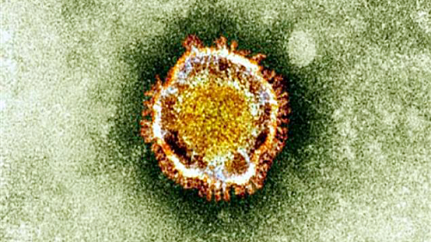 مصر : تسجيل أول إصابة بفيروس كورونا