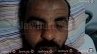الاعتداء بالعنف على عضو الاتحاد العام لطلبة تونس عصام السلامي