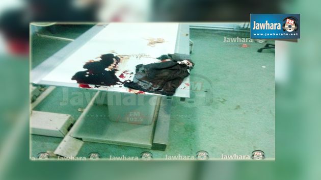 الكاف : نقل عون الغابات المصاب إلى مستشفى جندوبة وبتر ساقه