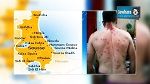 سوسة : إصابة شخص بالرش عن طريق الخطأ في أحد الأعراس