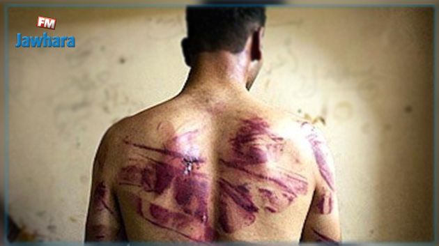التعهد بـ308 ضحية للتعذيب وسوء المعاملة