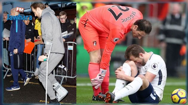 إصابة نجم المنتخب الإنجليزي هاري كين تهدد مشاركته في المونديال