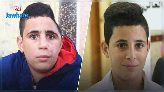 قوات الاحتلال تعتقل طفلًا جريحًا