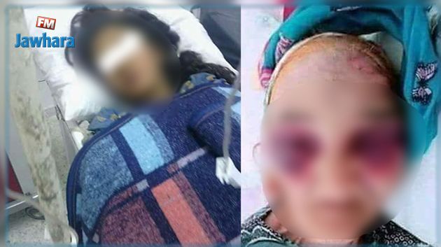 جريمة الاغتصاب في ڨبلاط : وزيرة المرأة تكشف ما ورد في تقرير الطب الشرعي
