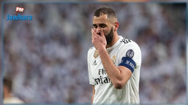 ريال مدريد يحدد طبيعة إصابة بنزيما