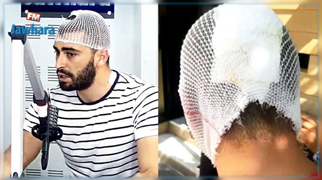 بعد حضوره مباراة كرة قدم : ينجو من الموت بأعجوبة ويخرج ب54