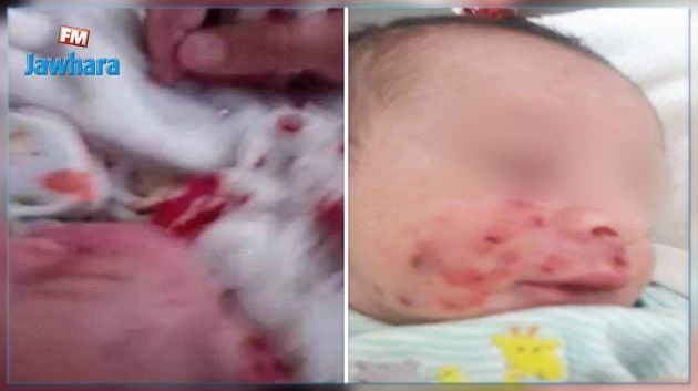 أحدهم روّج صورة رضيع قضمه فأر : المندوب الجهوي للصحّة يوضّح 