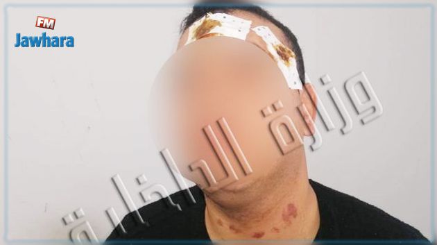 بنزرت : إيقاف شخص من أجل الإعتداء على عون أمن