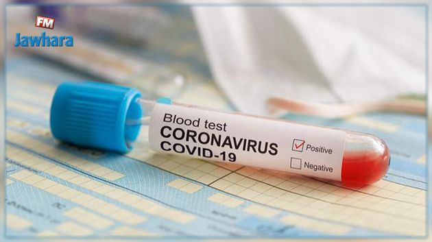 المنستير : تسجيل إصابة جديدة بفيروس كورونا