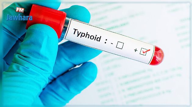 تطاوين: نقل 9 أشخاص إلى المستشفى بعد إصابتهم بالحمّى التيفية