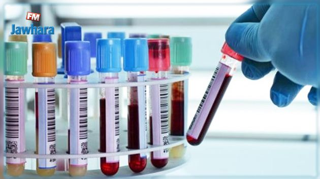 اليوم..صدور نتائج تحاليل الحالات المخالطة للمصابين بفيروس