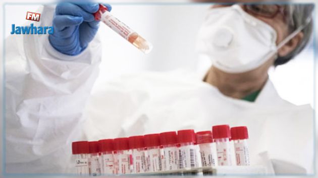 الجزائر : 483 إصابة جديدة بفيروس كورونا
