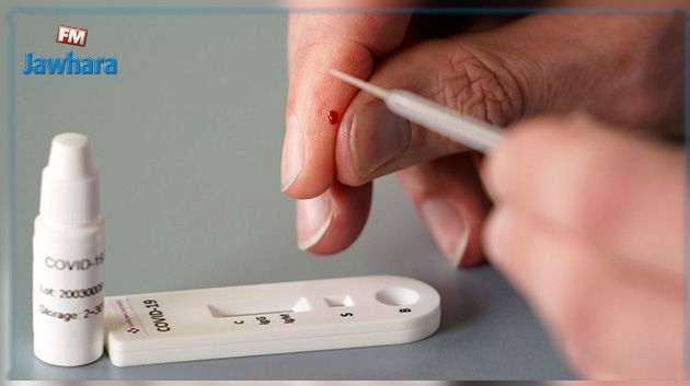دراسة تعتمد اختبارا جديدا للكشف عن كورونا أكثر فاعلية من اختبارات الأجسام المضادة
