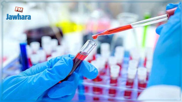 مدنين: اكتشاف بؤرة لانتشار فيروس