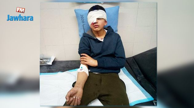 طفل فلسطيني يفقد البصر اثر رصاصة مطاطية من جنود الاحتلال اخترقت عينه (فيديو)