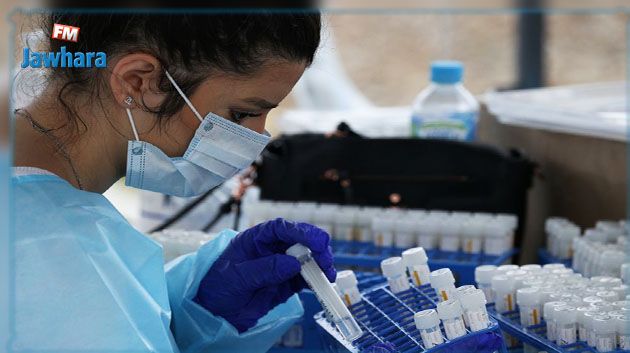 قبلي: تسجيل 24 اصابة جديدة بفيروس 