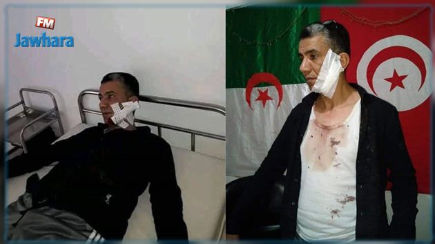 مجهولون يعتدون على ناشط حقوقي داخل مكتبه في جندوبة