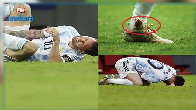 لعب رغم الدماء: ميسي يؤكد أنه قائد لمنتخب الأرجنتين