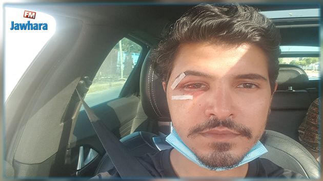 مواطن يؤكّد تعرّضه لاعتداء بالعنف الشديد والتعذيب من طرف أمنيين اثر شكاية ضد