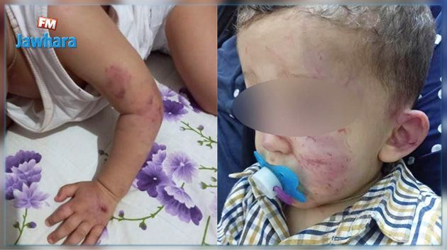 والد الطفل المعنف داخل روضة بالقيروان يؤكد عدم غلقها ومندوب حماية الطفولة يوضح