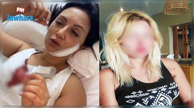 قضية البراكاج ضد الإعلامية سحر حامد : صدور الحكم في حق المتهمة