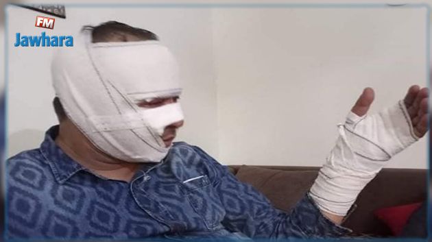 خلال مداهمة أمنية: بائع خمر يضرم النار في منزله ويتسبب لإطار أمني في حروق