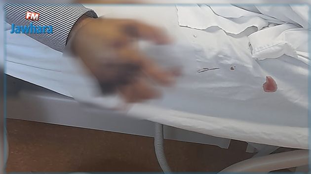 وفاة مريض بالسرطان بعد جرح بسيط ناتج عن تقليم أظافره : مدير مستشفى فرحات حشاد يوضح