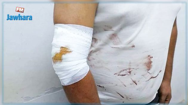 السفارة تتدخّل.. طالبان فلسطينيان في تونس يتعرّضان لبراكاج واصابات خطيرة 