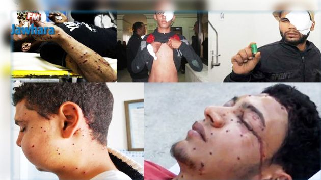 سليانة: عدد من جرحى الرشّ يحتجّون أمام مقرّ الولاية