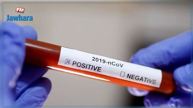 المهدية : تسجيل 169 إصابة جديدة بفيروس كورونا 