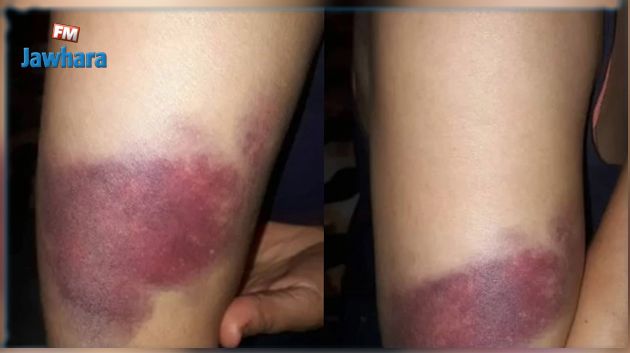 موظفة ببلدية تطلق نداء استغاثة: حياتي مهدّدة بعد إبلاغي عن شبهات فساد