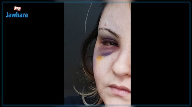 تعرضت للعنف في الطريق العام ثم أصبحت متهمة : مواطنة تطلب من القضاء انصافها