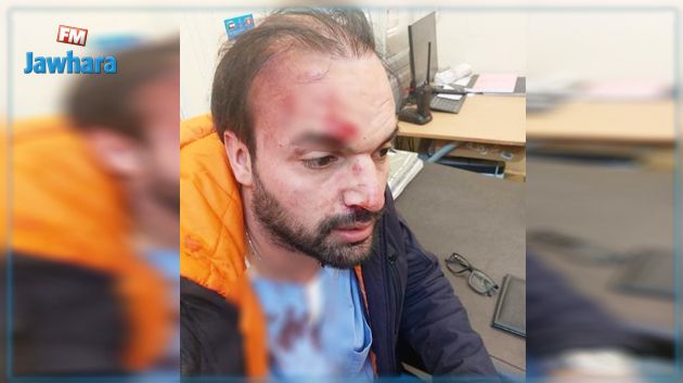 قفصة: الاعتداء بالعنف الشديد على طبيب مختص في جراحة العظام