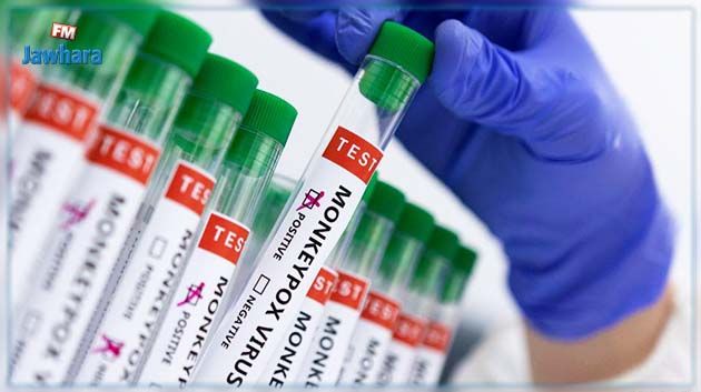 اختبار لقاح جديد للوقاية من