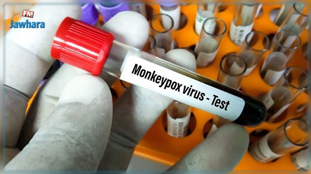 أستاذ في علم الفيروسات: تونس لم تسجل الى غاية اليوم حالات مشتبه بها للاصابة بجدري القردة