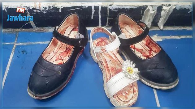 اليمن.. إصابة 11 طفلا في قصف على حي سكني