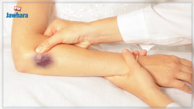 الدكتور الغزال: بشرى للمصابين بهذا المرض