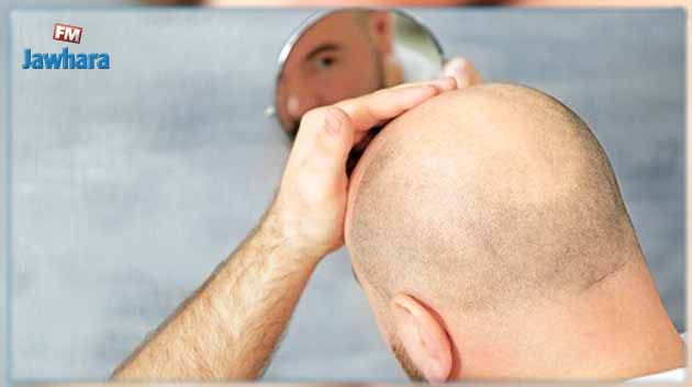 علماء يُطوّرون علاجًا مُحتملاً للصّلع وتساقط الشّعر