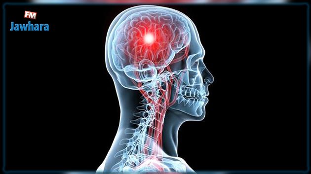 أطباء يكشفون 5 أعراض تُشير إلى مرض خطير في الدماغ