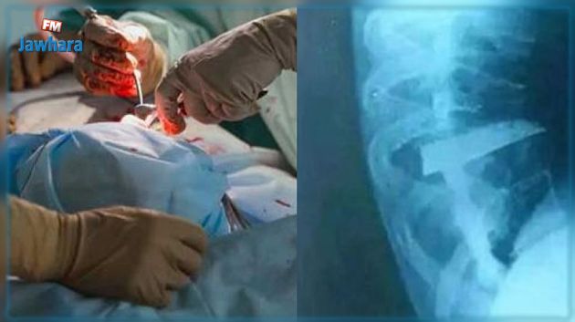 الطبيب المُشرف على عملية إزالة سكين من ظهر جزائري يكشف آخر تطورات وضعه الصحي (فيديو)