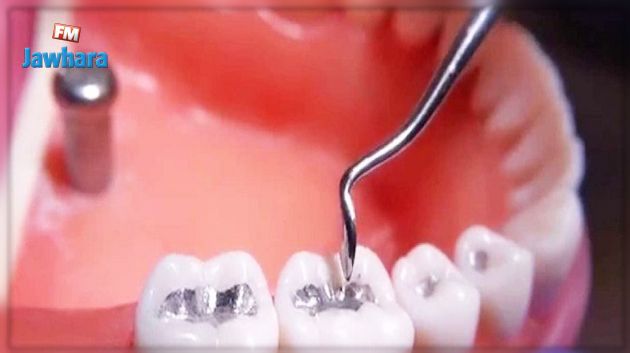 وزارة الصحّة تمنع استعمال ملغم الأسنان في علاج الأسنان