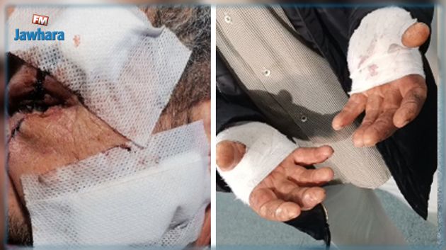 حمّام سوسة: كهل يتعرّض لـ