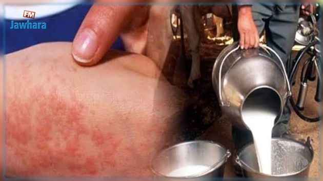 باجة: رصد 8 إصابات بمرض الحمى المالطية